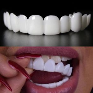 لمینت دندان متحرک چیست